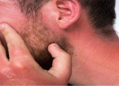 برترین راه مشاوره آنلاین با دکتر پوست