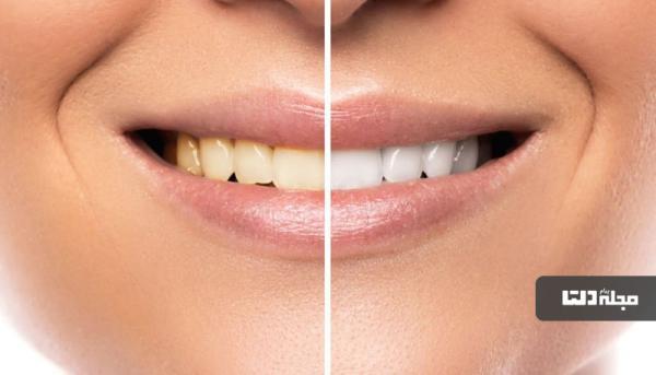 10 نکته مهم قبل از مراجعه به دندانپزشکی